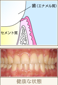 健康な状態